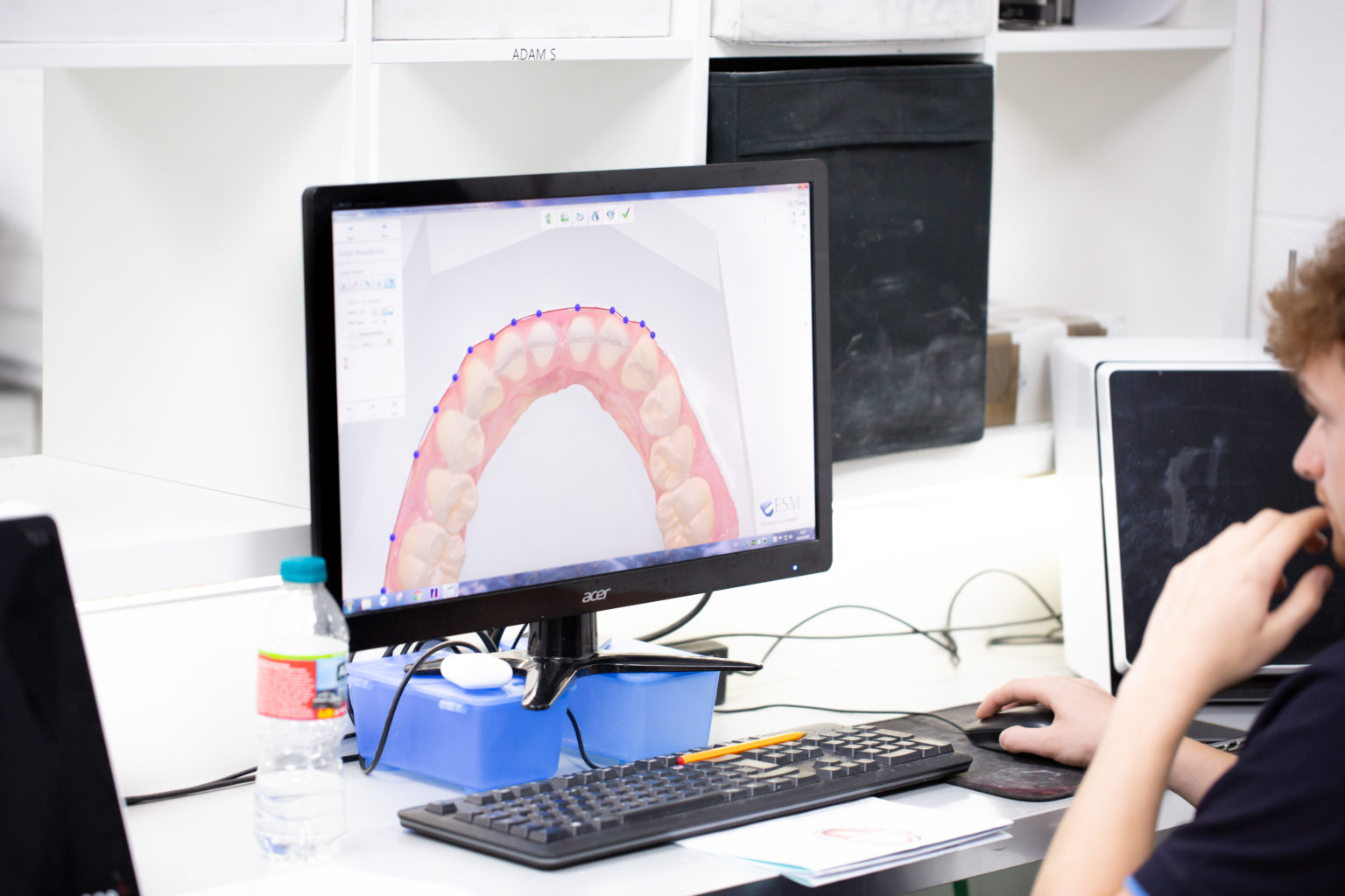 Give Digital Study Models a go - Cardiff Ortho